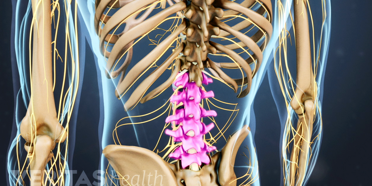 Vật lý trị liệu thoát vị đĩa đệm cột sống thắt lưng Vật lý trị liệu thoát vị đĩa đệm cột sống thắt lưng