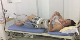 Kéo giãn cột sống Kéo giãn cột sống