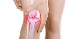 Vật lý trị liệu thoái hóa khớp gối Vật lý trị liệu thoái hóa khớp gối