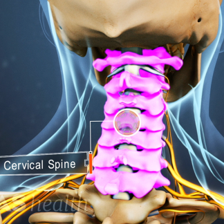 Vật lý trị liệu thoát vị đĩa đệm cột sống cổ