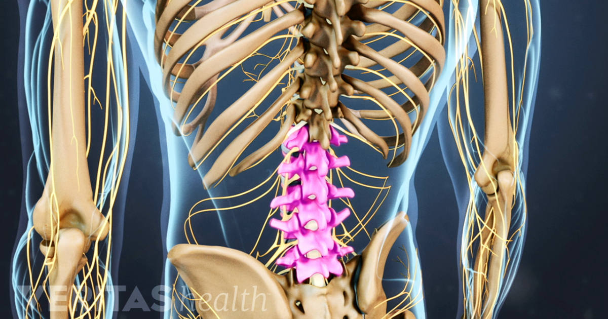 Vật lý trị liệu thoát vị đĩa đệm cột sống thắt lưng Vật lý trị liệu thoát vị đĩa đệm cột sống thắt lưng