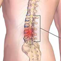 Tác động cột sống